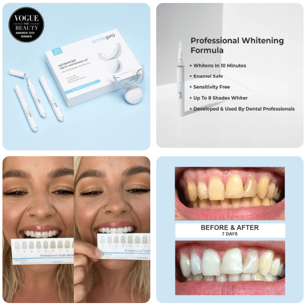 We create SEO-optimized, conversion-driven online stores for premium dentists to sell teeth whitening products.